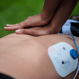 Automated external defibrillator in use on a patient receiving CPR